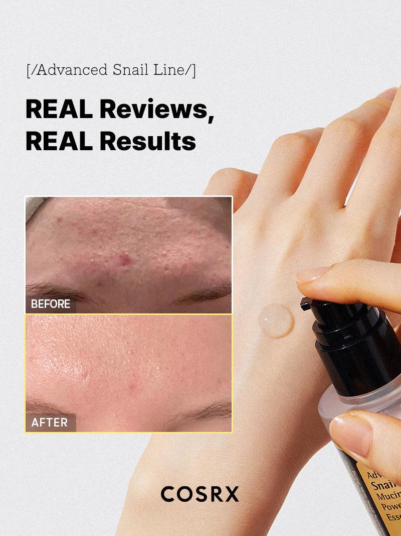 COSRX 96% snail secretion filtrate