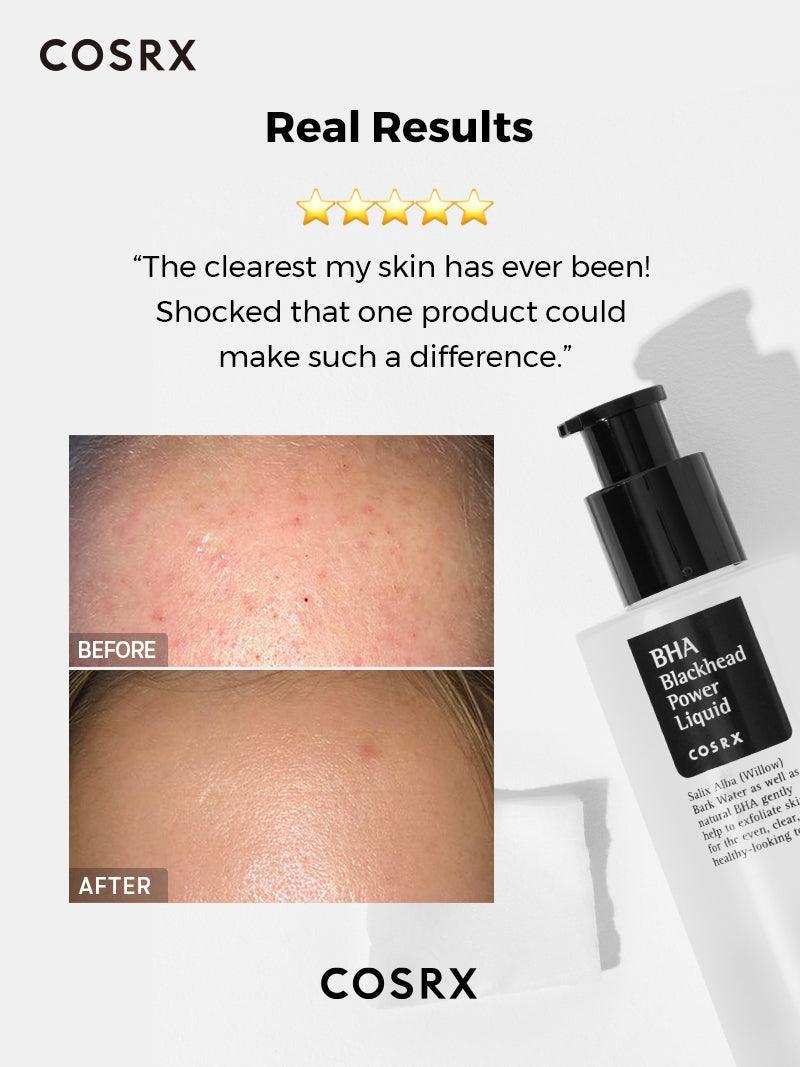 COSRX - BHA Blackhead Power Liquid 100ml