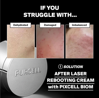 PURCELL Pixcell Biom Probiotics Rebooting Cream – before and after showing improvement in dehydrated, damaged, and imbalanced skin with Korean probiotic microbiome cream