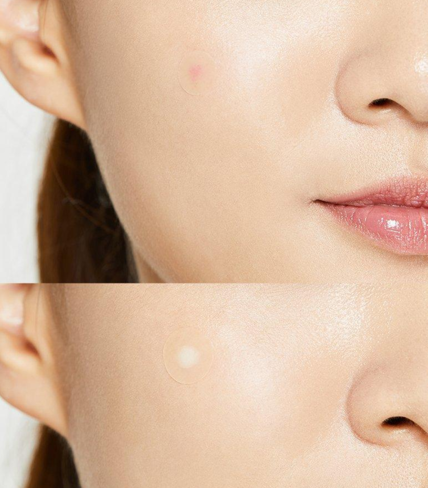 COSRX Acne Pimple Master Patch