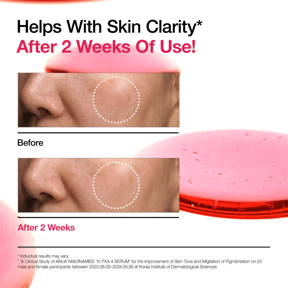 Before and after comparison of skin clarity on a white background