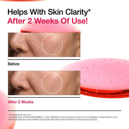 Before and after comparison of skin clarity on a white background